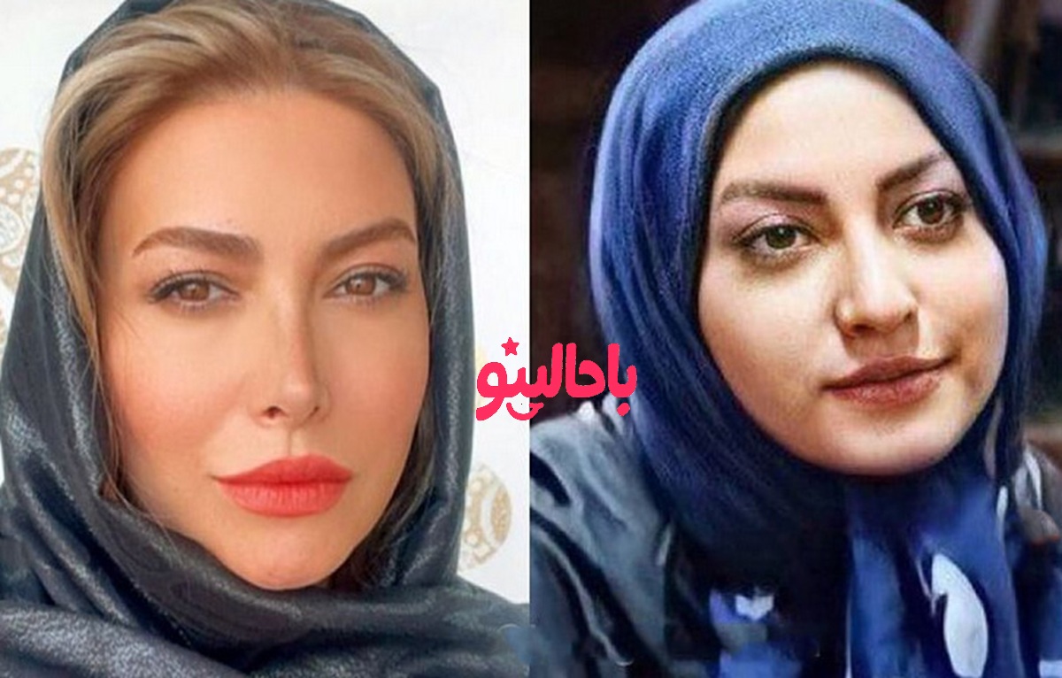 فریبا نادری قبل عمل بینی