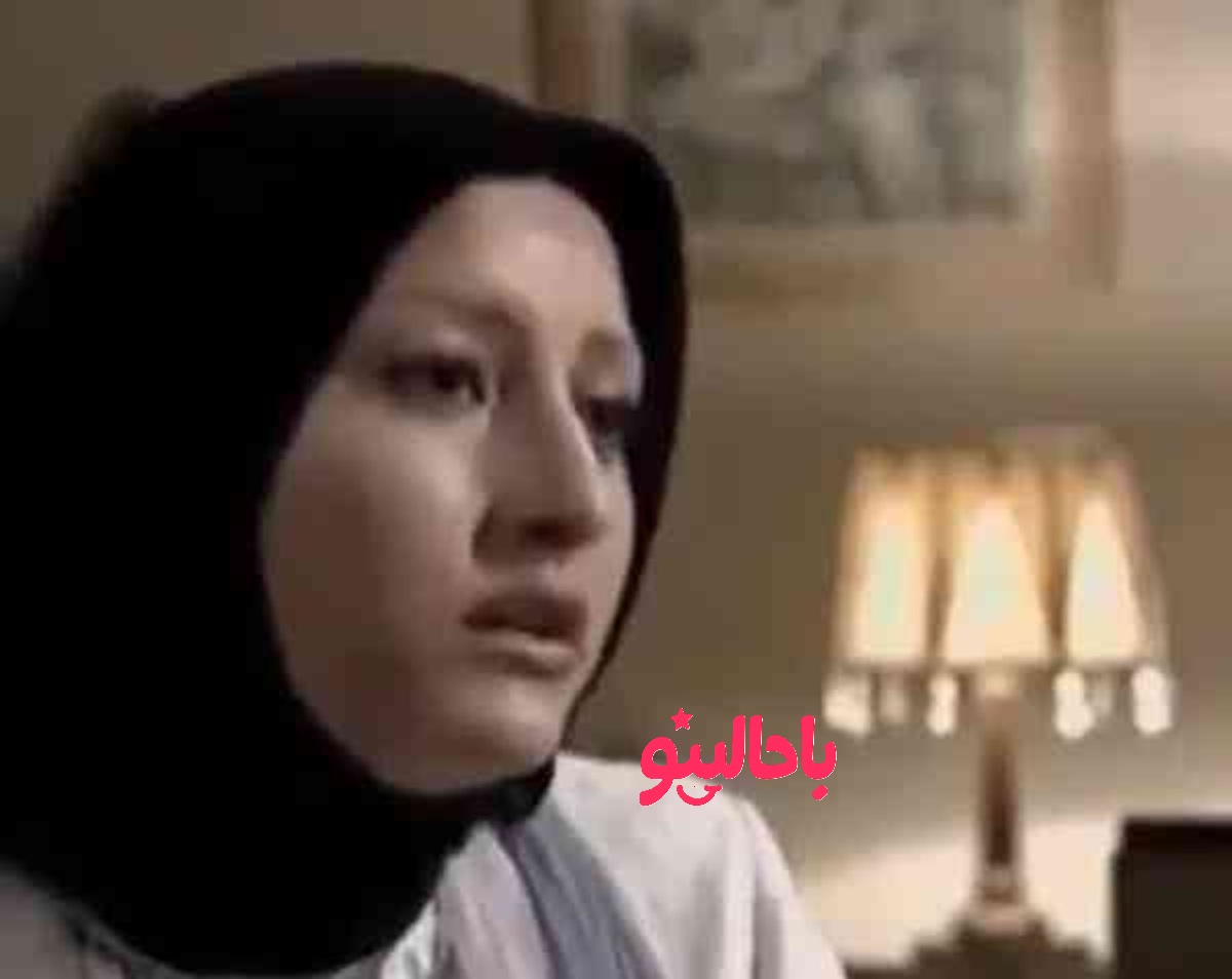 فریبا نادری قبل عمل بینی2