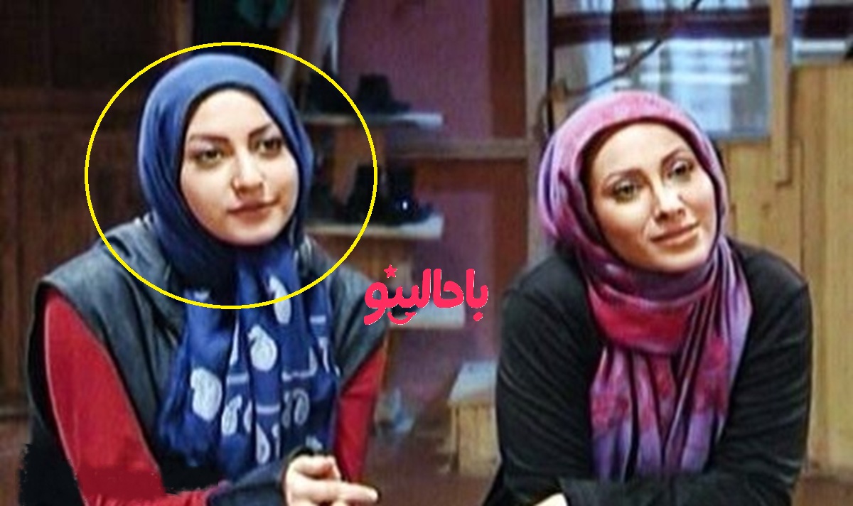 فریبا نادری قبل عمل بینی3